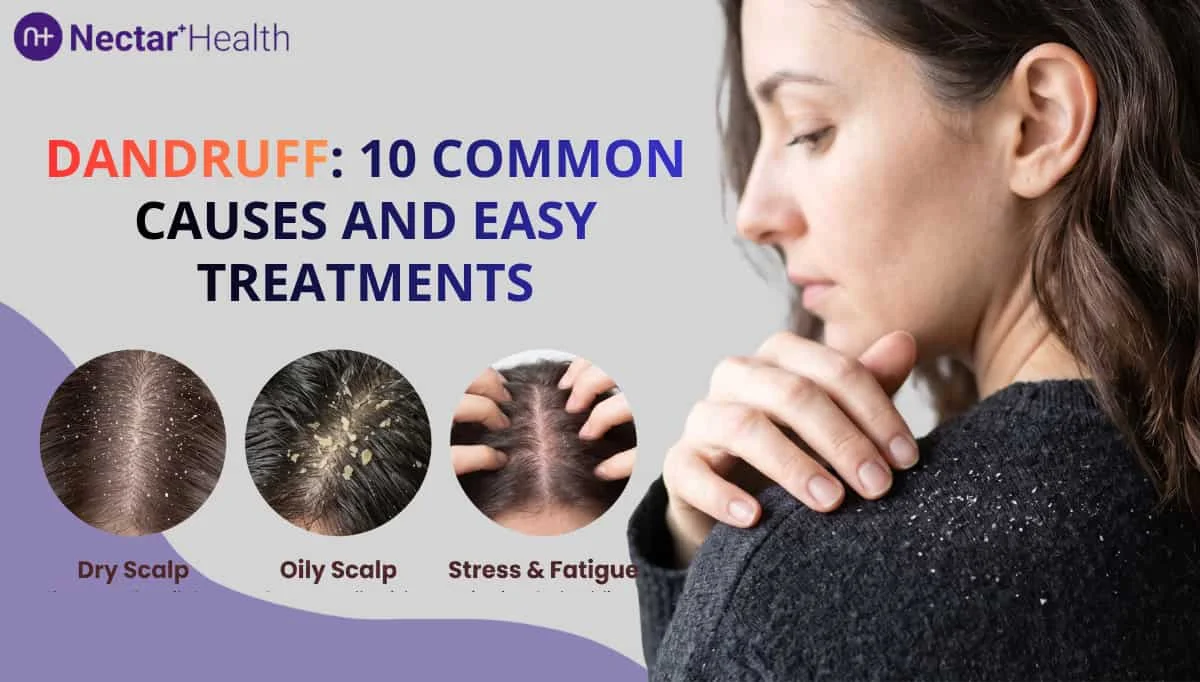 Dandruff: Causes, Treatment and Hair-Care Tips