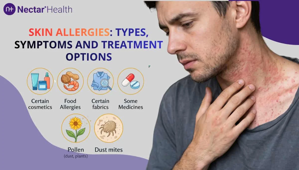 Skin Allergy: Common Triggers, Symptoms, Treatment and Prevention