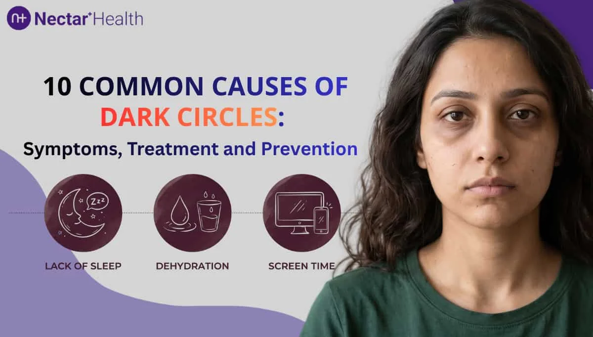 10 Common Causes of Dark Circles Under the Eyes: Treatment and Prevention