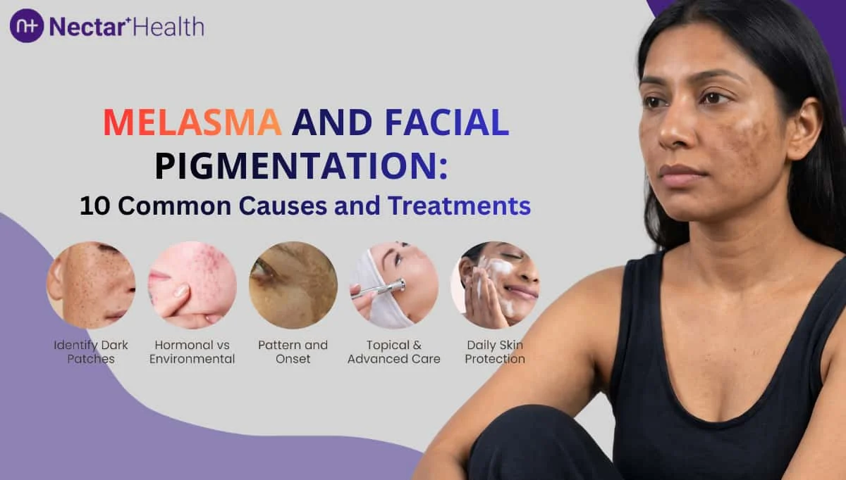Melasma and Facial Pigmentation: Causes and Treatment